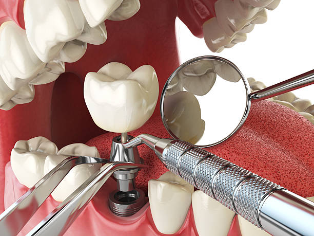 Best Urgent Tooth Repair  in Simsbury Center, CT